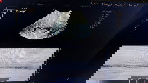 Usia 10 weeks, bagaimana bun?