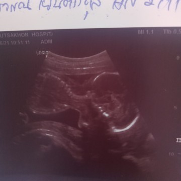ได้21+6w แล้วค่ะ