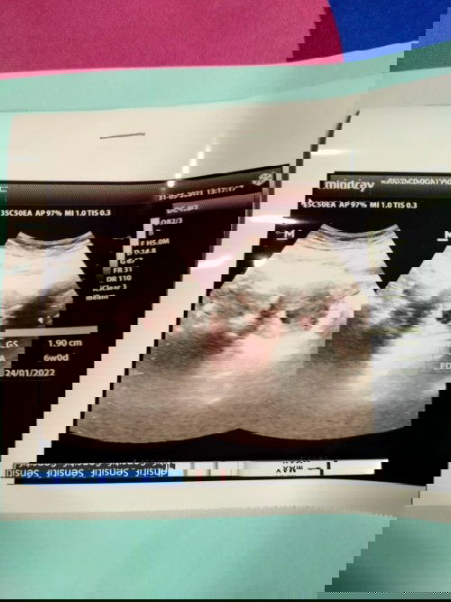 ekayulianti1503@gmail.com