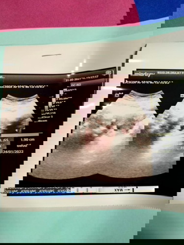 ekayulianti1503@gmail.com