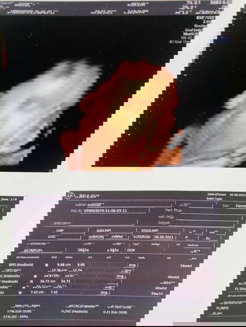 Mohon Doanya Bunda 😇🙏🏽🥰