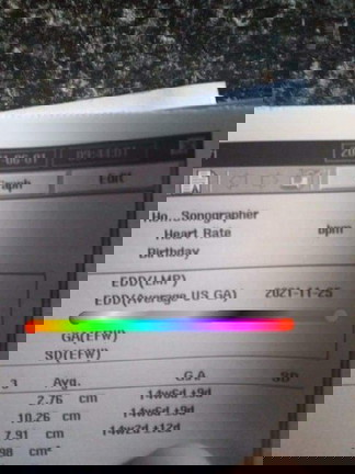 ที่ขีดเส้นไว้ ใช่กำหนดคลอดหรือป่าวคะ