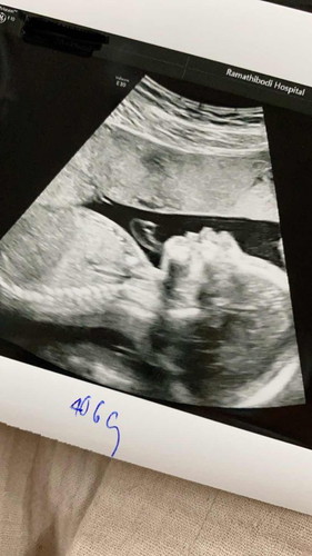 บ้านนี้ได้ลูกชายค่า