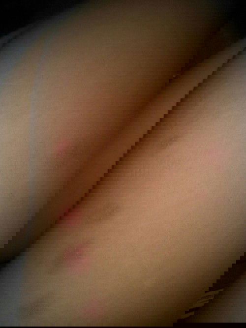 hallo bun,ad yg pernah kek gini?cara atasinya gimana?