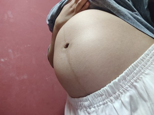ท้องแบบนี้ หญิงหรือชายคะ🥰