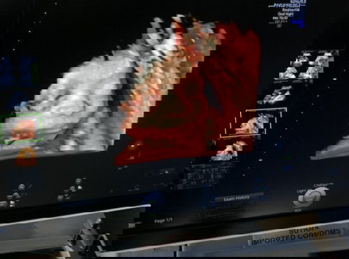 Tips naikan bb janin