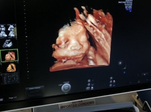 Tips naikan bb janin