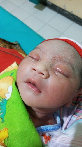 Lahir di uk 38w4d