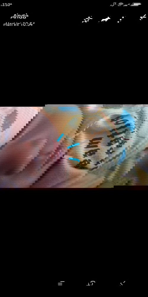 Bibir terlihat seperti itu.