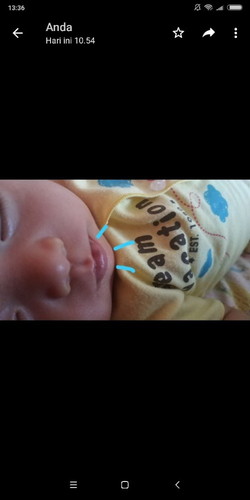 Bibir terlihat seperti itu.