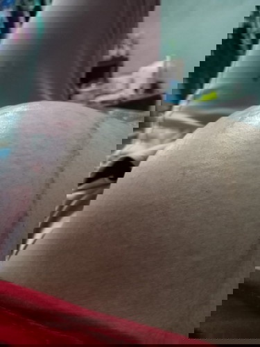 ท้องแข็งบ่อยมาก