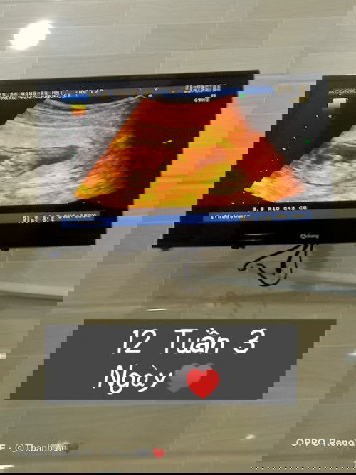 Cảm ơn cục vàng đến với mẹ ♥️