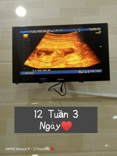Cảm ơn cục vàng đến với mẹ ♥️