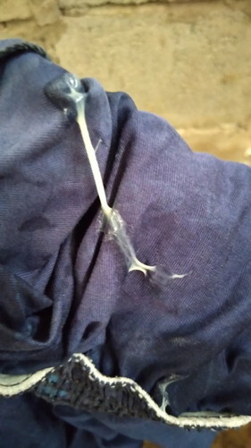 ท้องแรก37+5