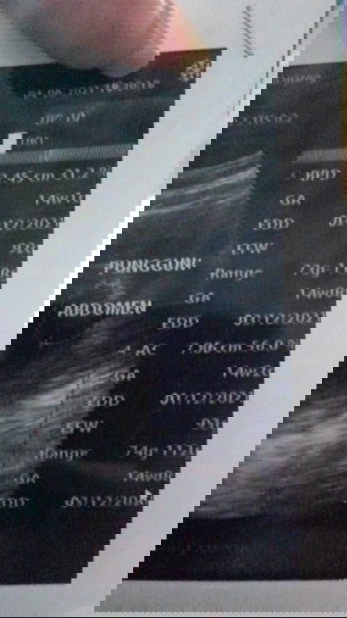 Info berat baby 14week