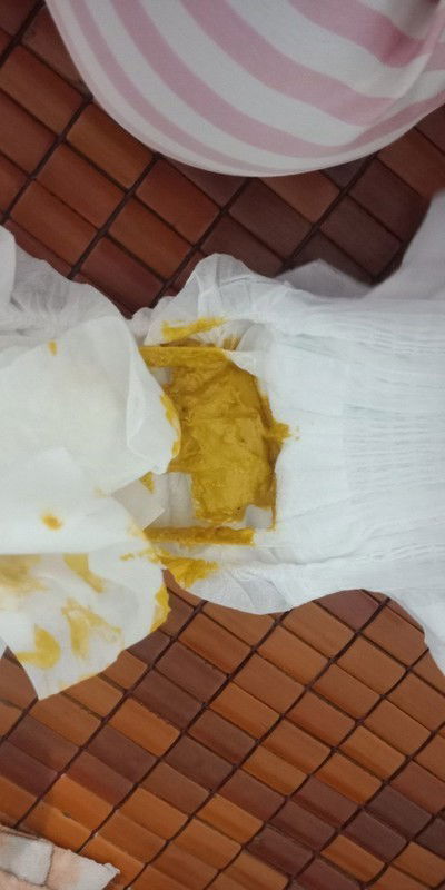 Phân trẻ sơ sinh