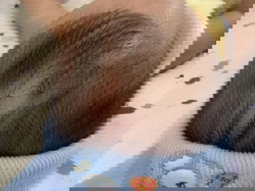 เวลาจะนอนลูกชอบเกาหัวจนผมหายไป แบบนี้ผมจะขึ้นไหมคะ หรือแม่ๆคนไหนที่ลูกเคยเป็นแบบนี่บ้างคะ