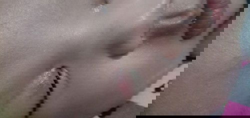 Merah Di Kelopak Mata