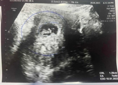 แม่ๆช่วยดูทีค่ะ