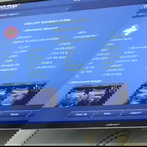 รบกวนแม่ๆๆ