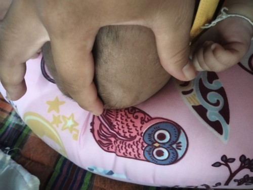 ช่วยบอกทีค่ะแม่กังวลมาก ๆปหาหมอมาแล้ว นัดอีกที่17ค่ะ