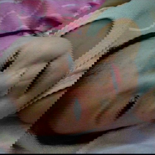 Muncul merah2 di area muka dan badan