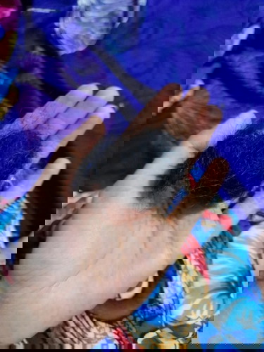 Rambut rontok saat hamil