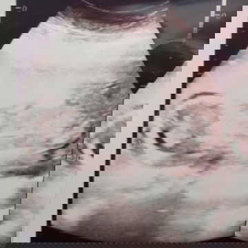 Posisi Bayi Telentang (18Week)