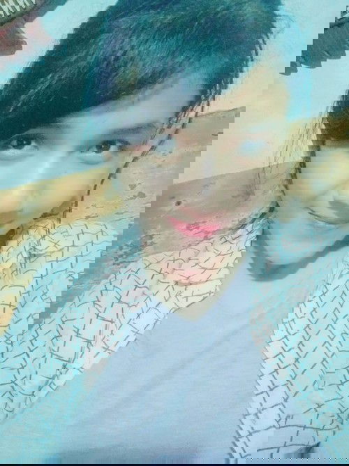 Lagi hamil tapi tetap kurus