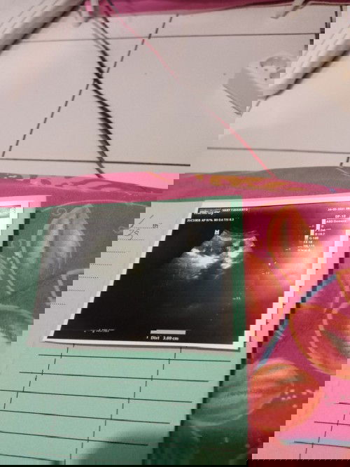 Hasil USG pasca flek