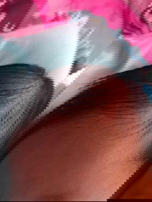 beruntusan atau apa ya?