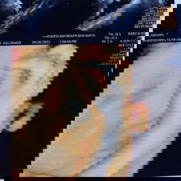 36t chưa thay mặt