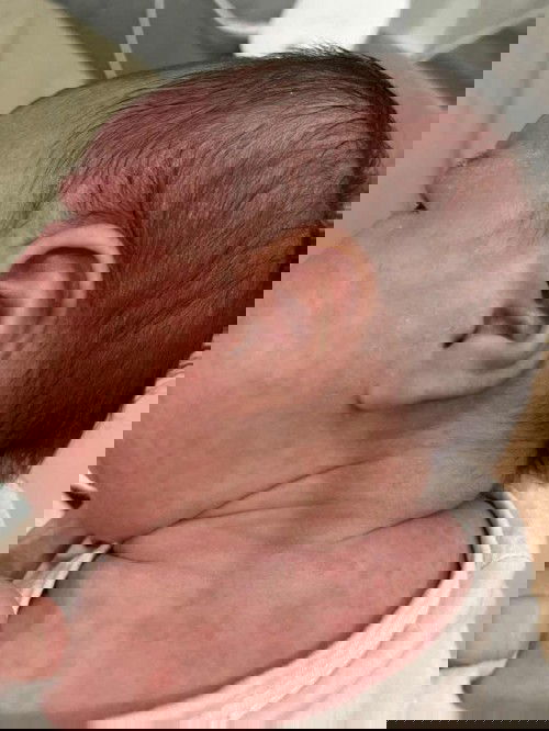 น้องเป็นผื่นแดง ทั้งตัวใครพอจะทราบสาเหตุไหมคะ