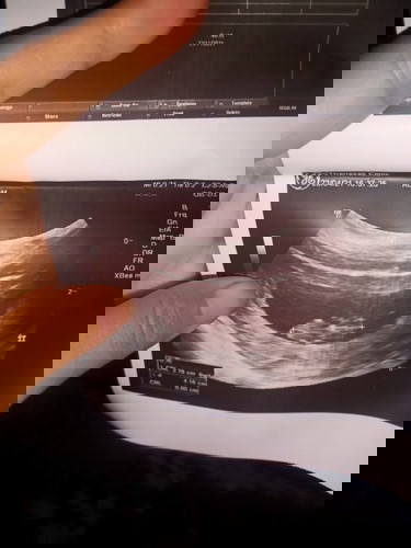 คิดถึงใจจะขาด