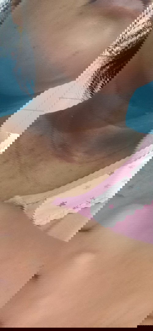 Leher Menghitam Gatal dan Berjerawat