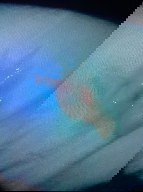 สงสัยว่ามูกเลือดมันจะออกตลอดไหมค่ะ