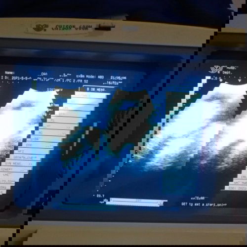 Bolehkah Ibu Hamil Tetap Melakukan Sholat Walau Dlm Keadaan Hamil Besar