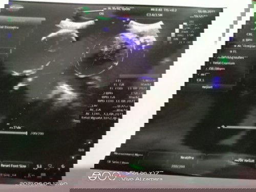 Mengurangi makan nasi