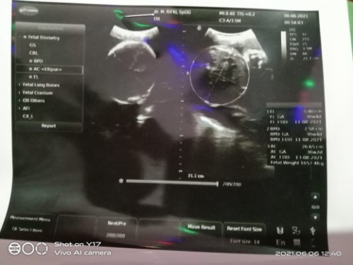 Mengurangi makan nasi