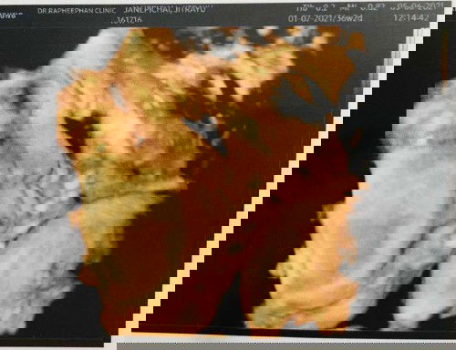 ลูกน้ำหนักไม่ขึ้น