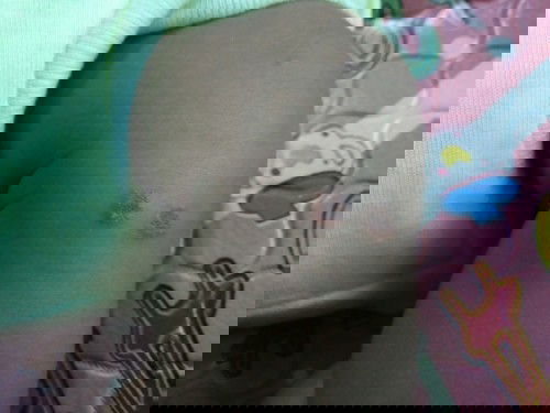 Alergi atau apa ini bund ?