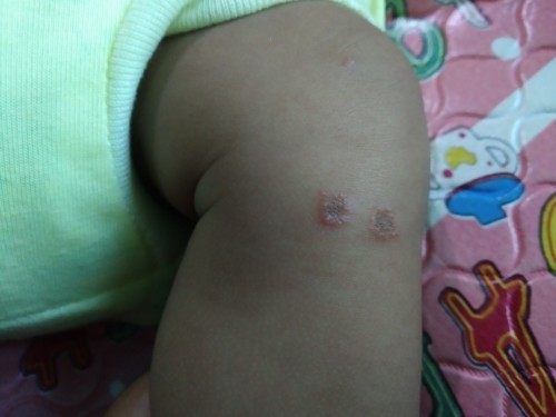 Alergi atau apa ini bund ?