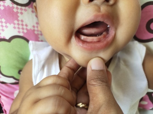 Teething ????
