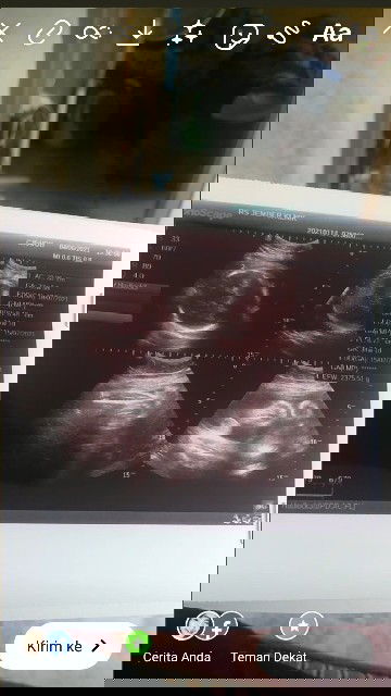 Curhat tentang Babyboyku dan kehamilanku