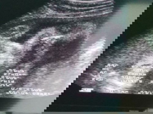 27สัปดาห์​