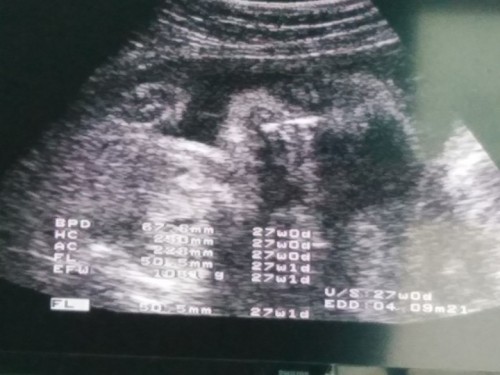 27สัปดาห์