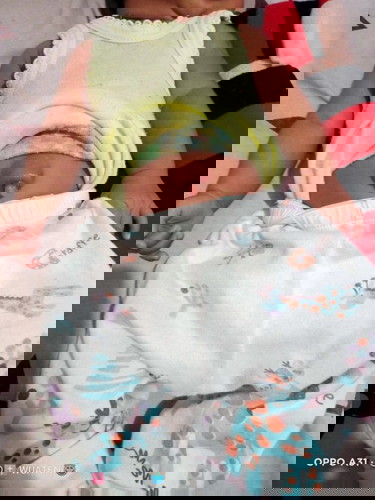 Bodong/Hernia Umbilikalis?