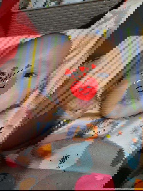 Panu atau bercak putih dan gatal di wajah bayi