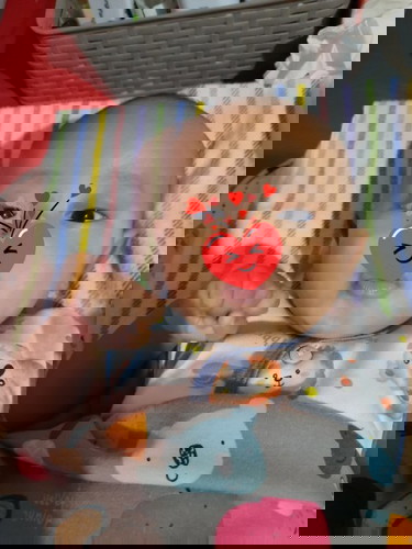 Panu atau bercak putih dan gatal di wajah bayi