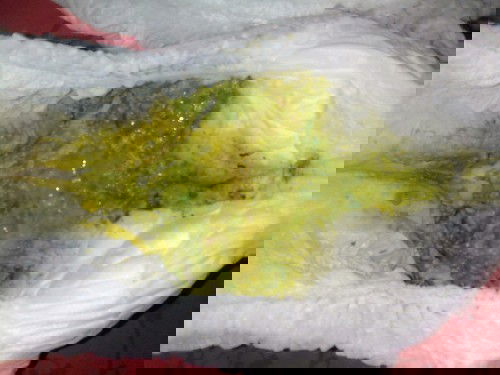 ขอสอบถามขอคำแนะนำสำหรับแม่ๆหน่อยคะว่าอันตรายไหม